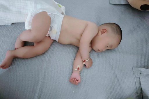 开平宝宝头上长痱子